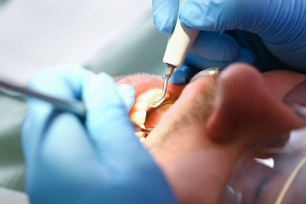 Best Emergency Dentist for Knocked-Out Tooth in Marthasville, MO